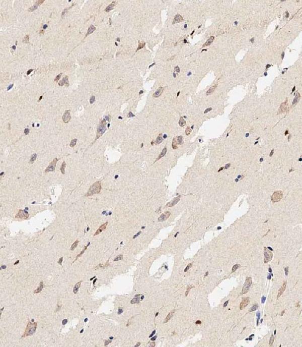 m01543 2 anti map1lc3a antibodyn term ihc p leica testing 3