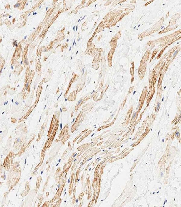 m01543 2 anti map1lc3a antibodyn term ihc p leica testing 4