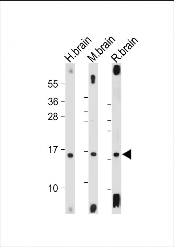 m01543 2 anti map1lc3a antibodyn term wb testing 2