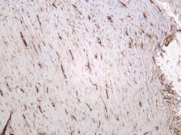 Rat colon was stained with anti-LC3A rabbit antibody