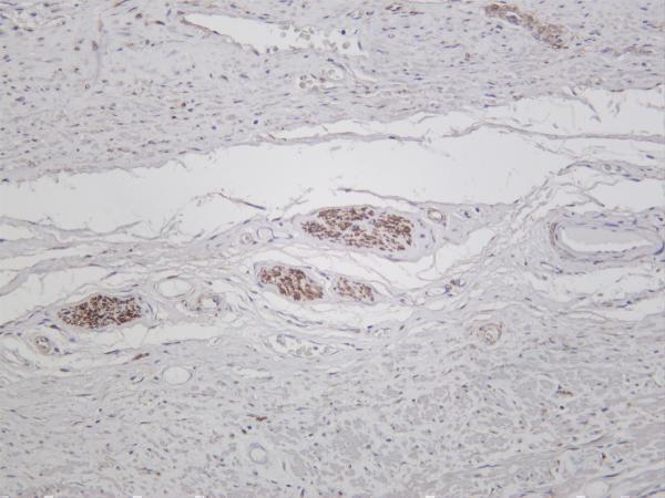 Human prostate was stained with anti-LC3A rabbit antibody