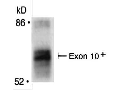 m01551 2 bin1 primary antibodies ip testing 2