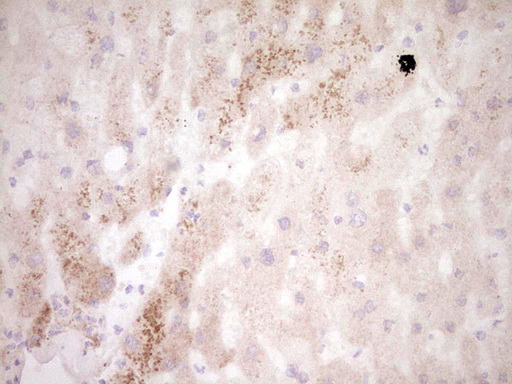 Immunohistochemical staining of paraffin-embedded Human liver tissue within the normal limits using anti-MMP7 mouse monoclonal antibody