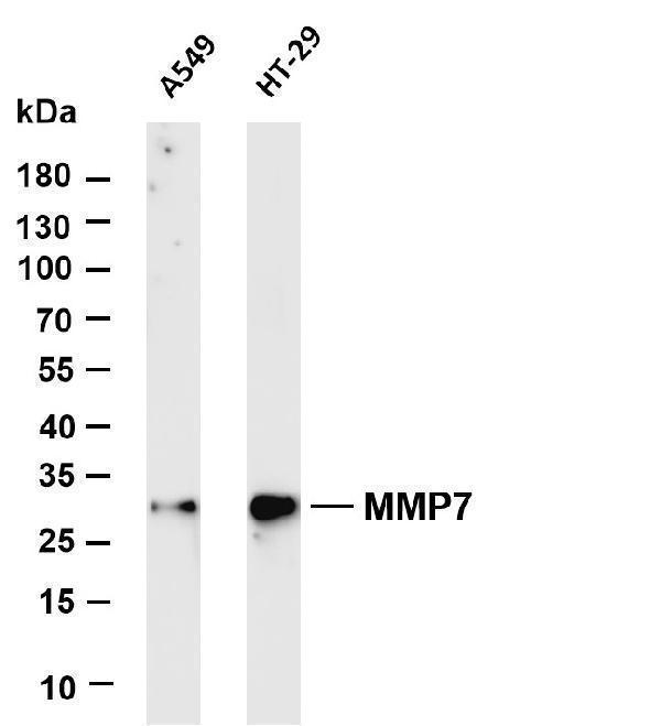 Various whole cell lysates were separated by 4-20% SDS-PAGE, and the membrane was blotted with anti-MMP7 antibody