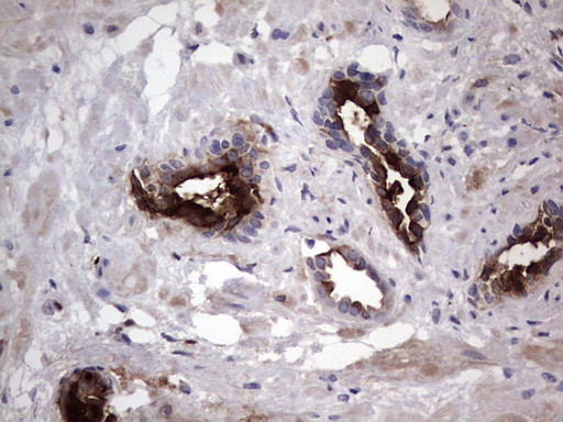 m01553 anti mmp7 mouse monoclonal antibody clone id oti3g7 ihc testing 4