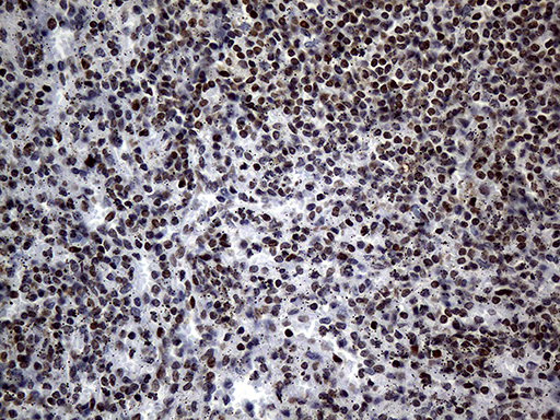 m01557 1 anti ppar delta ppard mouse monoclonal antibody clone id oti4d10 ihc testing 4