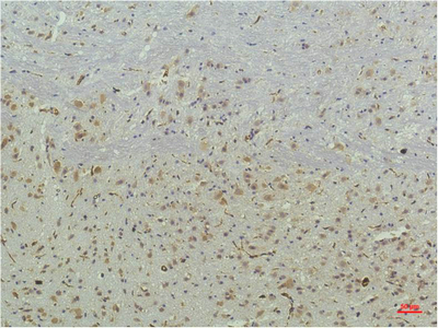 Immunohistochemistry validation of PPARD using Anti-PPAR Delta Monoclonal Antibody (M01557)