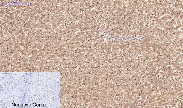 Immunohistochemistry validation of PPARD using Anti-PPAR Delta Monoclonal Antibody (M01557)