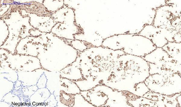 Immunohistochemistry validation of PPARD using Anti-PPAR Delta Monoclonal Antibody (M01557)
