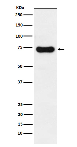 Western blot analysis of IRAK2 expression in HeLa cell lysate