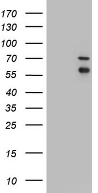 HEK293T cells were transfected with the pCMV6-ENTRY control (Left lane) or pCMV6-ENTRY IRAK2 (Right lane) cDNA for 48 hrs and lysed
