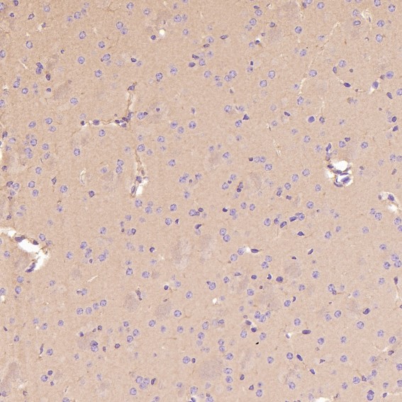 m01561 1 ihc11_1