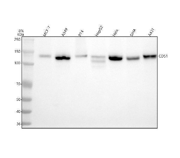  Western blot analysis of ITGAV using anti-ITGAV antibody (M01561-2)