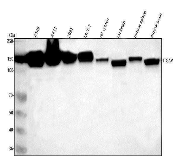  Western blot analysis of ITGAV using anti-ITGAV antibody (M01561)