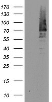 HEK293T cells were transfected with the pCMV6-ENTRY control (Left lane) or pCMV6-ENTRY BIRC3 (Right lane) cDNA for 48 hrs and lysed
