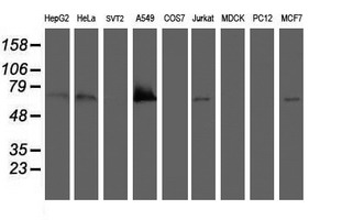 Western blot analysis of extracts (35ug) from 9 different cell lines by using anti-BIRC3 monoclonal antibody (HepG2: human; HeLa: human; SVT2: mouse; A549: human; COS7: monkey; Jurkat: human; MDCK: canine; PC12: rat; MCF7: human)