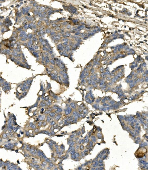 m01564 2 bubr1 bub1b primary antibodies ihc testing 2
