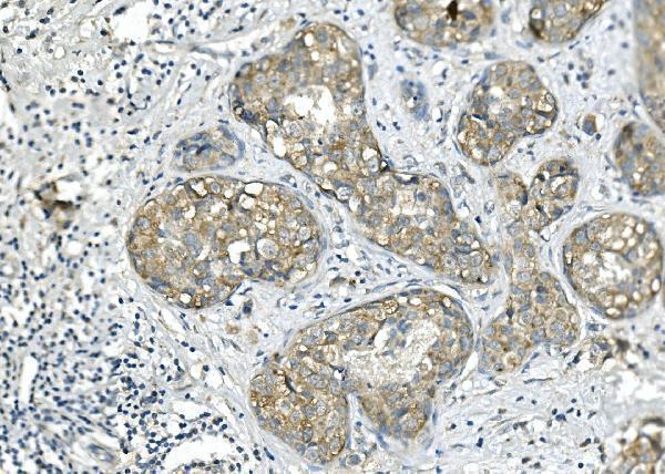 m01564 2 bubr1 bub1b primary antibodies ihc testing 3