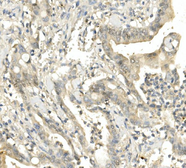 m01564 2 bubr1 bub1b primary antibodies ihc testing 5