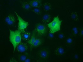 m01564 anti bubr1 bub1b mouse monoclonal antibody clone id oti6e3 if testing 6