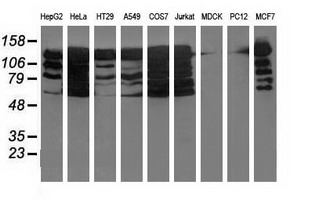 m01564 anti bubr1 bub1b mouse monoclonal antibody clone id oti6e3 wb testing 2