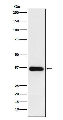 Western blot analysis of HSD11B1 expression in human fetal liver lysate