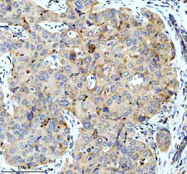 IHC analysis of HSD11B1 using anti-HSD11B1 antibody (M01565-2)