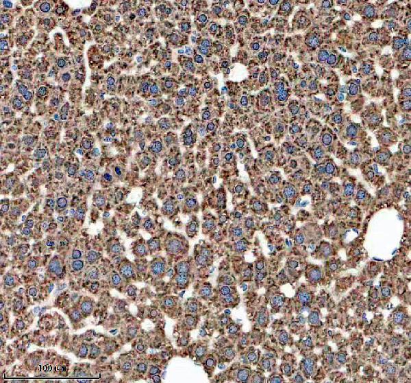 IHC analysis of HSD11B1 using anti-HSD11B1 antibody (M01565-2)
