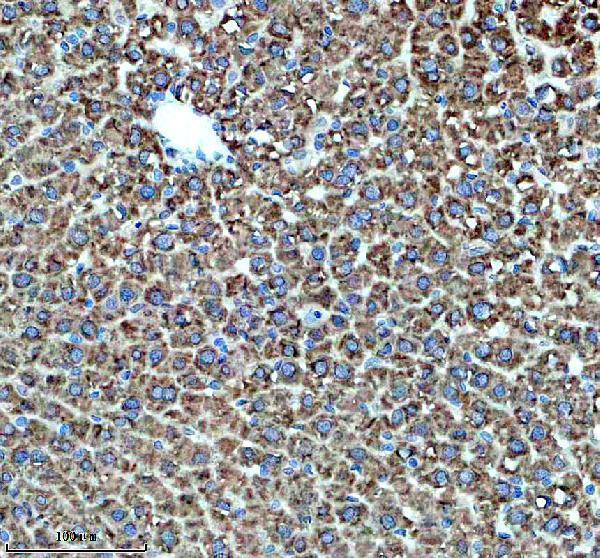 m01565 2 hsd11b1 primary antibodies ihc testing 3
