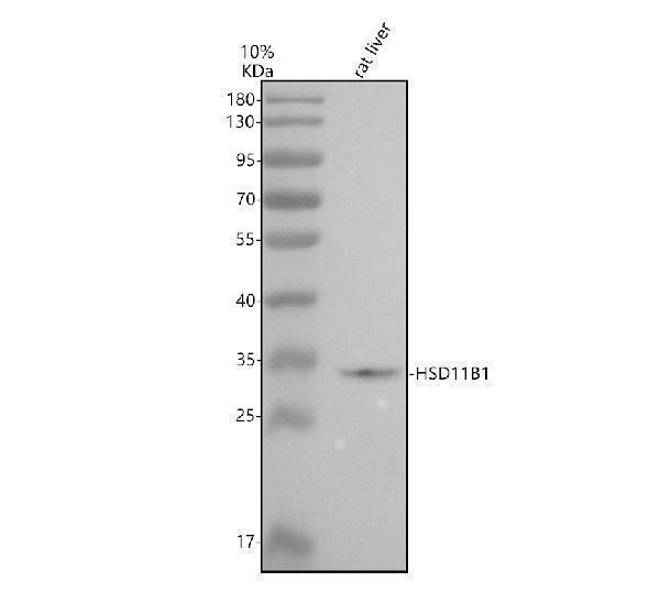 Western blot analysis of HSD11B1 using anti-HSD11B1 antibody (M01565-2)