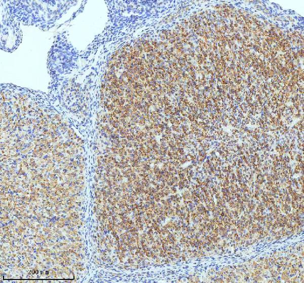Figure 2. IHC analysis of OXTR using anti-OXTR antibody (M01566). OXTR was detected in a paraffin-embedded section of rat ovary tissue. Heat mediated antigen retrieval was performed in EDTA buffer (pH 8.0, epitope retrieval solution). The tissue section was blocked with 10% goat serum. The tissue section was then incubated with 1:50 rabbit anti-OXTR Antibody (M01566) overnight at 4°C. Peroxidase Conjugated Goat Anti-rabbit IgG was used as secondary antibody and incubated for 30 minutes at 37°C. The tissue section was developed using HRP Conjugated Rabbit IgG Super Vision Assay Kit (Catalog # SV0002) with DAB as the chromogen.