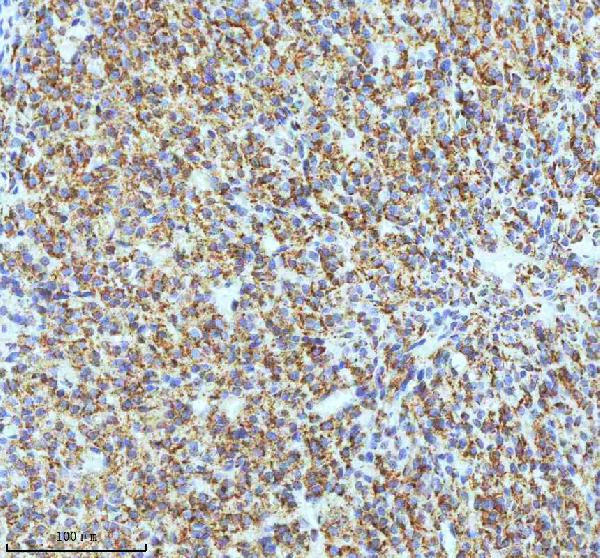 Figure 3. IHC analysis of OXTR using anti-OXTR antibody (M01566). OXTR was detected in a paraffin-embedded section of rat ovary tissue. Heat mediated antigen retrieval was performed in EDTA buffer (pH 8.0, epitope retrieval solution). The tissue section was blocked with 10% goat serum. The tissue section was then incubated with 1:50 rabbit anti-OXTR Antibody (M01566) overnight at 4°C. Peroxidase Conjugated Goat Anti-rabbit IgG was used as secondary antibody and incubated for 30 minutes at 37°C. The tissue section was developed using HRP Conjugated Rabbit IgG Super Vision Assay Kit (Catalog # SV0002) with DAB as the chromogen.