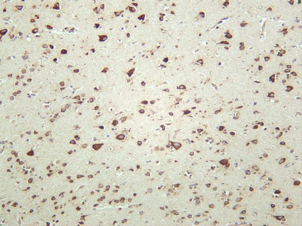 Human brain was stained with anti-RPS6 rabbit antibody