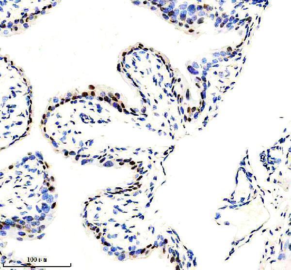 IHC analysis of P-RPS6 using anti-P-RPS6 antibody (M01567-2)