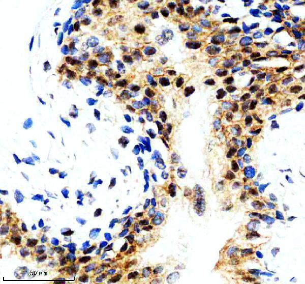 IHC analysis of P-RPS6 using anti-P-RPS6 antibody (M01567-2)