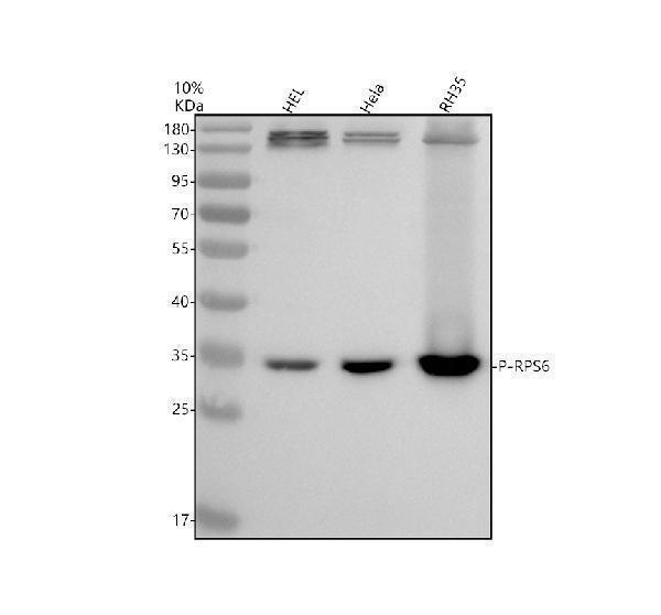 Western blot analysis of P-RPS6 using anti-P-RPS6 antibody (M01567-2)