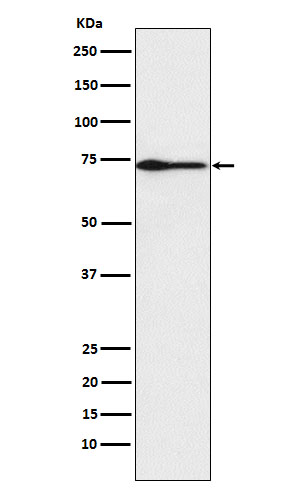 Western blot analysis of PROS1 expression in Human plasma lysate