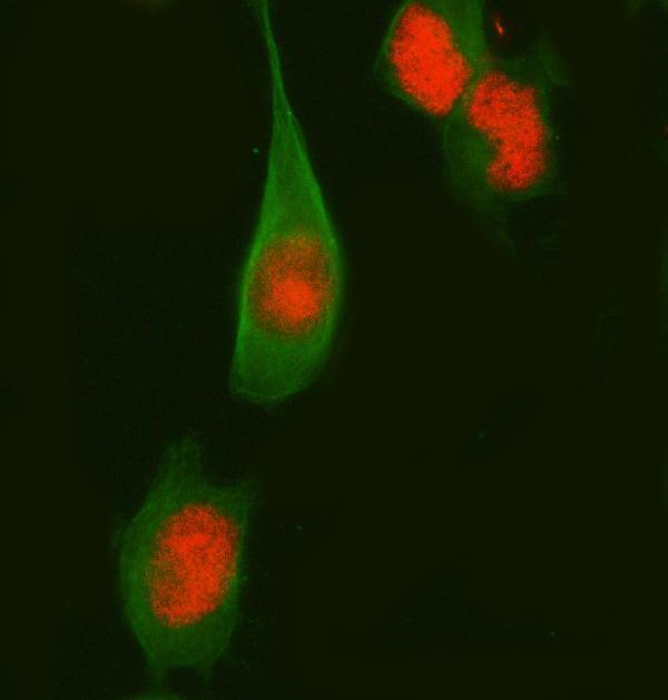 m01569 fosb primary antibodies if testing 4
