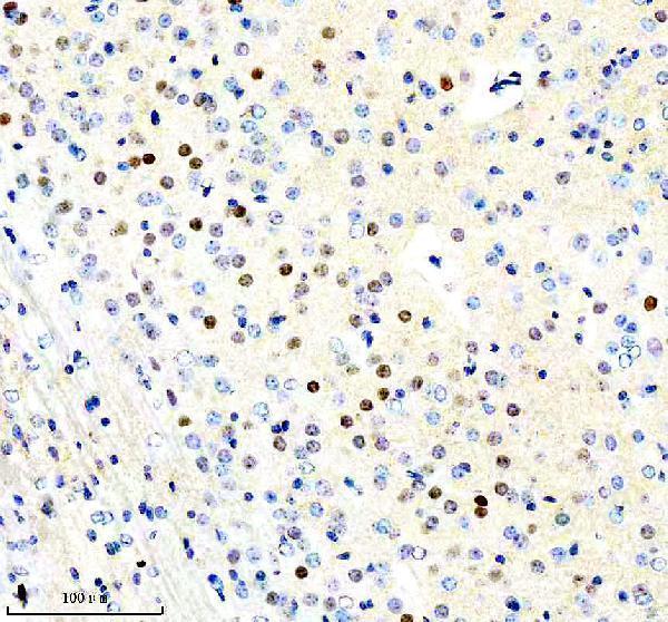  IHC analysis of Fos B using anti-Fos B antibody (M01569)
