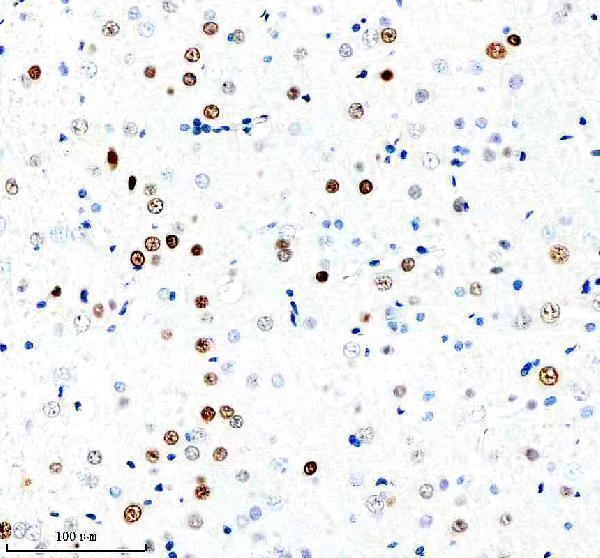  IHC analysis of Fos B using anti-Fos B antibody (M01569)
