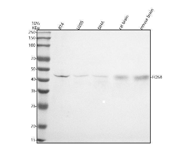  Western blot analysis of Fos B using anti-Fos B antibody (M01569)