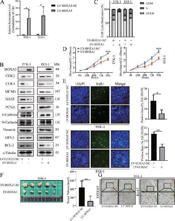 HOXA5 overexpression attenuates the malignant behaviors of ECCA cells