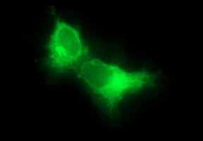 m01572 3 anti cd22 mouse monoclonal antibody clone id oti1f12 if testing 3