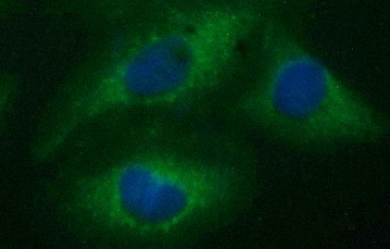 m01572 3 anti cd22 mouse monoclonal antibody clone id oti1f12 if testing 4