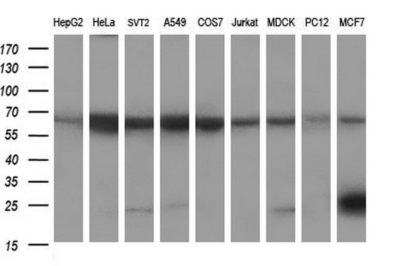 m01572 3 anti cd22 mouse monoclonal antibody clone id oti1f12 wb testing 2