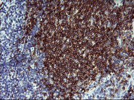 m01572 4 anti cd22 mouse monoclonal antibody clone id oti4c3 ihc testing 3