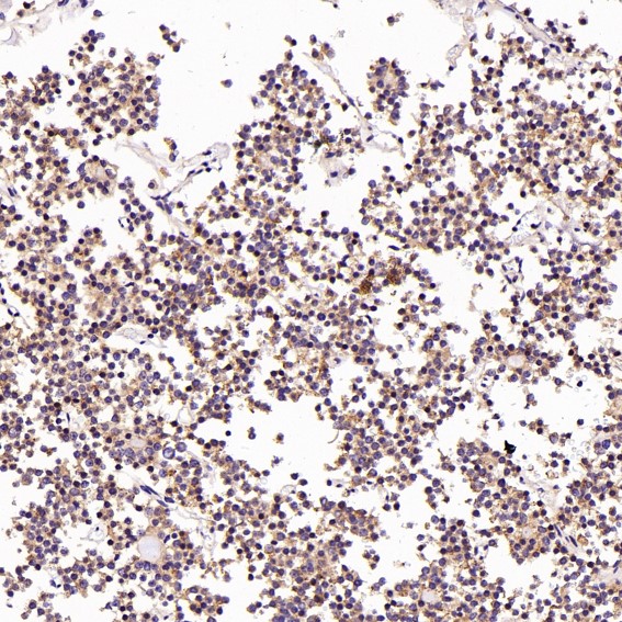 m01573 ihc7