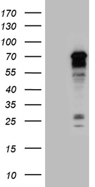 HEK293T cells were transfected with the pCMV6-ENTRY control (Left lane) or pCMV6-ENTRY PPM1D (Right lane) cDNA for 48 hrs and lysed