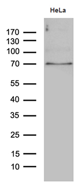 Western blot analysis of extracts (35ug) from HELA cell lines by using anti-PPM1D monoclonal antibody (1:500)