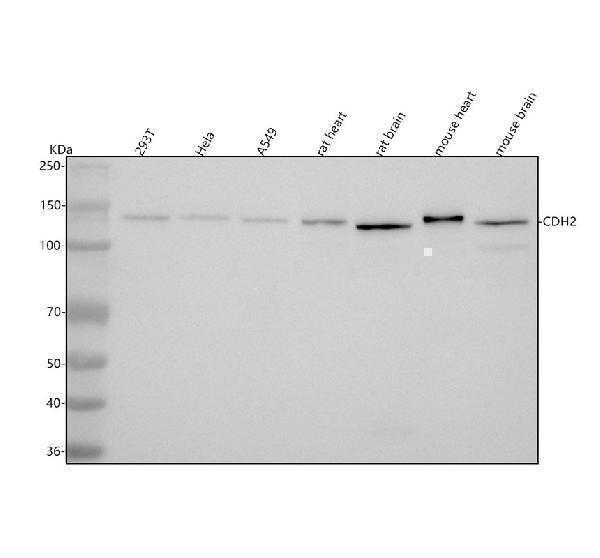  Western blot analysis of CDH2 using anti-CDH2 antibody (M01577-1)